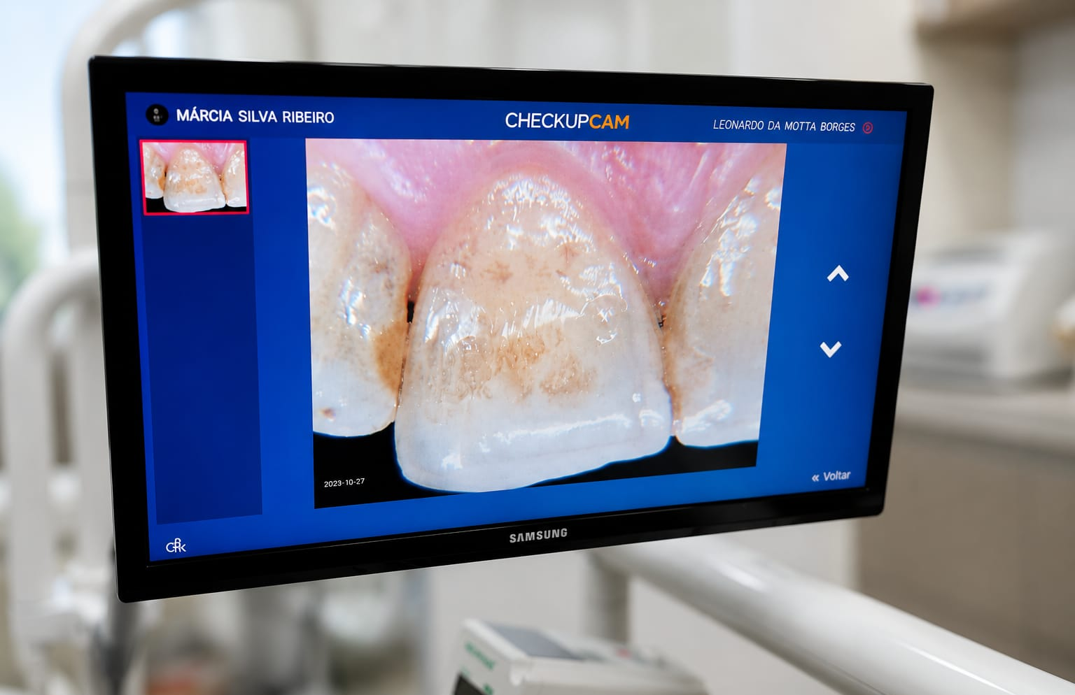 Check-up preventivo digital, CheckupCam